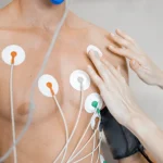 ECG Electrode for Chest Placement